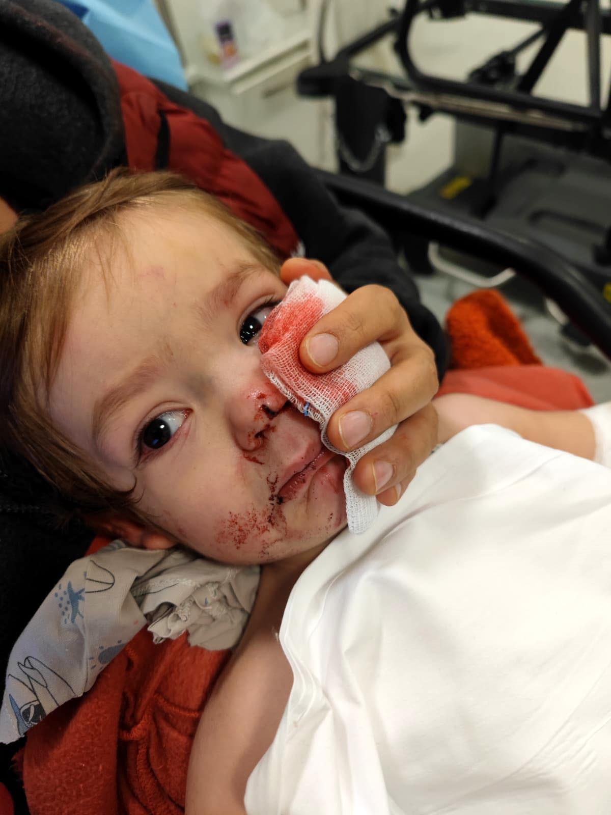 2 kardeşe saldıran pitbull ile ilgili 12 şikayet yapılmış